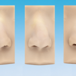 Deviated+crooked+asian Front