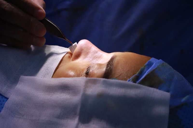 Mũi bị khiếm khuyết hay biến dạng thì nên phẫu thuật để khắc phục tình trạng